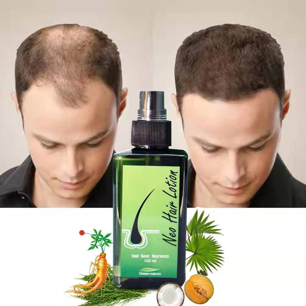 Neo Hair Lotion Price in Pakistan |Buy Online at Best Sale Price